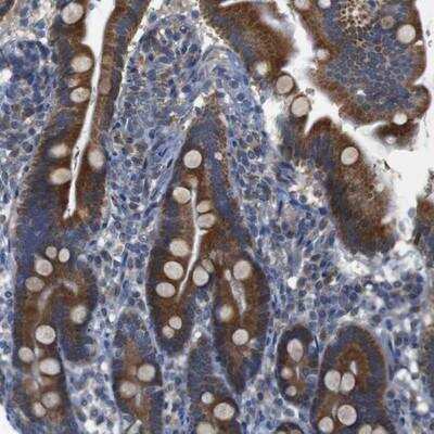 Immunohistochemistry-Paraffin: Carbohydrate Sulfotransferase 10/CHST10 Antibody [NBP1-81727]
