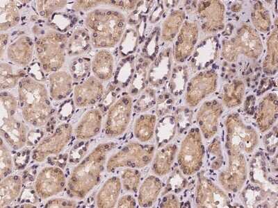 Immunohistochemistry-Paraffin: Carbohydrate Sulfotransferase 10/CHST10 Antibody [NBP2-97238]