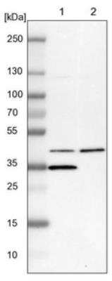 Western Blot: Carbohydrate Sulfotransferase 10/CHST10 Antibody [NBP1-81727]