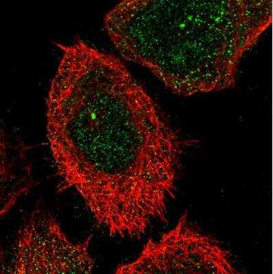 Immunocytochemistry/ Immunofluorescence: Carbohydrate Sulfotransferase 15/CHST15 Antibody [NBP1-88367]