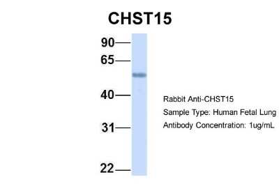 Western Blot: Carbohydrate Sulfotransferase 15/CHST15 Antibody [NBP1-59012]