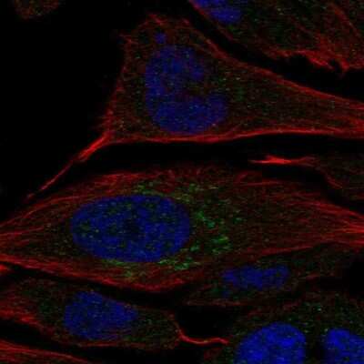 Immunocytochemistry/ Immunofluorescence: Carbohydrate Sulfotransferase 2/CHST2 Antibody [NBP2-55604]