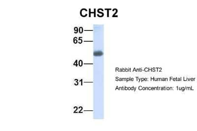 Western Blot: Carbohydrate Sulfotransferase 2/CHST2 Antibody [NBP1-59944]