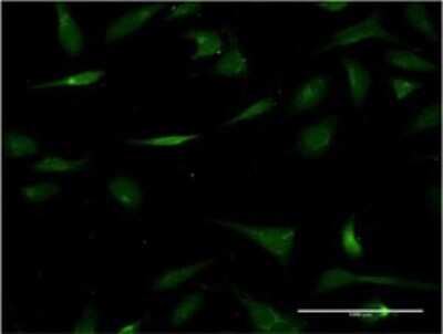 Immunocytochemistry/ Immunofluorescence: Carbohydrate Sulfotransferase 3/CHST3 Antibody (1D3) [H00009469-M02]