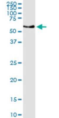 Western Blot: Carbohydrate Sulfotransferase 3/CHST3 Antibody (1D3) [H00009469-M02]