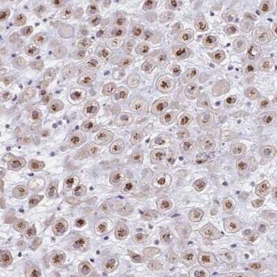 Immunohistochemistry: Carbohydrate Sulfotransferase 3/CHST3 Antibody [NBP2-31611]