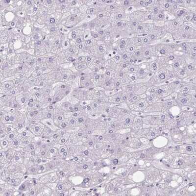 Immunohistochemistry-Paraffin: Carbohydrate Sulfotransferase 3/CHST3 Antibody [NBP2-31611]