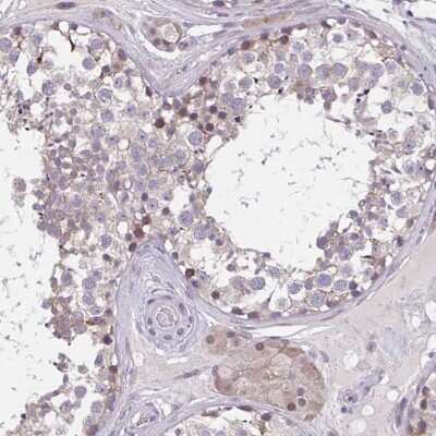 Immunohistochemistry-Paraffin: Carbohydrate Sulfotransferase 3/CHST3 Antibody [NBP2-31611]