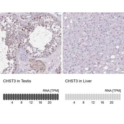 Immunohistochemistry-Paraffin: Carbohydrate Sulfotransferase 3/CHST3 Antibody [NBP2-31611]