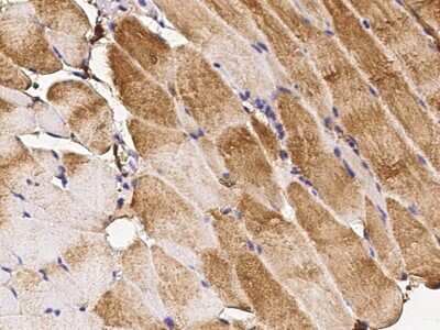 Immunohistochemistry-Paraffin: Carbohydrate Sulfotransferase 3/CHST3 Antibody [NBP2-98311]