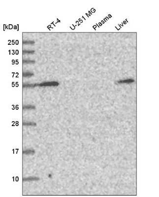 Western Blot: Carbohydrate Sulfotransferase 3/CHST3 Antibody [NBP2-57128]