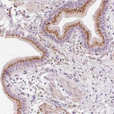 Immunohistochemistry-Paraffin: Carbohydrate Sulfotransferase 4/CHST4 Antibody [NBP1-91748]