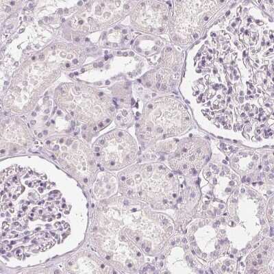 Immunohistochemistry-Paraffin: Carbohydrate Sulfotransferase 4/CHST4 Antibody [NBP1-91748]