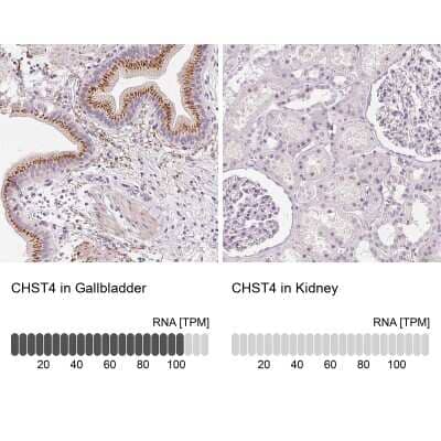 Immunohistochemistry-Paraffin: Carbohydrate Sulfotransferase 4/CHST4 Antibody [NBP1-91748]