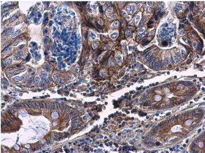 Immunohistochemistry-Paraffin: Carbohydrate Sulfotransferase 4/CHST4 Antibody [NBP2-15697]