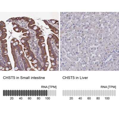 Immunohistochemistry-Paraffin: Carbohydrate Sulfotransferase 5/CHST5 Antibody [NBP1-91785]