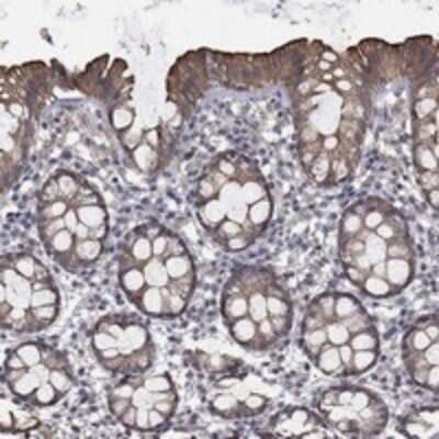 Immunohistochemistry-Paraffin: Carbohydrate Sulfotransferase 5/CHST5 Antibody [NBP3-17221]