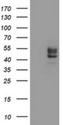 Western Blot: Carbohydrate Sulfotransferase 6/CHST6 Antibody (OTI1D1) [NBP2-45604]