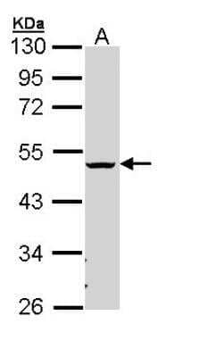 Western Blot: Carbohydrate Sulfotransferase 6/CHST6 Antibody [NBP1-32912]