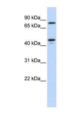 Western Blot: Carbohydrate Sulfotransferase 6/CHST6 Antibody [NBP1-57927]