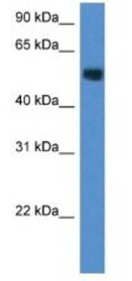 Western Blot: Carbohydrate Sulfotransferase 2/CHST2 Antibody [NBP1-79191]