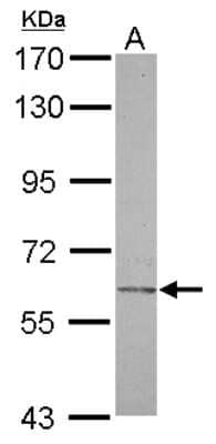 Western Blot: Carbohydrate Sulfotransferase 2/CHST2 Antibody [NBP2-15696]