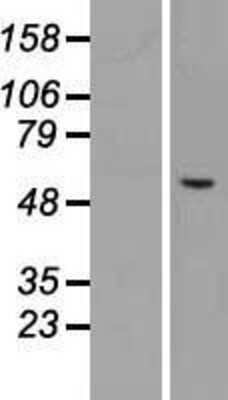 Western Blot: Carbohydrate Sulfotransferase 3/CHST3 Overexpression Lysate [NBL1-09195]