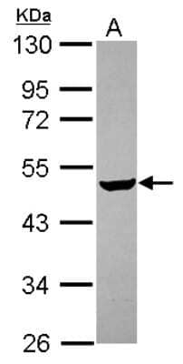 Western Blot: Carbohydrate Sulfotransferase 4/CHST4 Antibody [NBP2-15697]