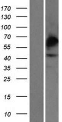 Western Blot: Carbohydrate Sulfotransferase 4/CHST4 Overexpression Lysate [NBP2-10441]