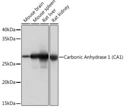 Western Blot: Carbonic Anhydrase I/CA1 Antibody (0G10F8) [NBP3-16404]