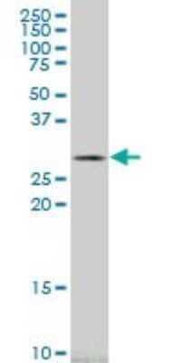 Western Blot: Carbonic Anhydrase I/CA1 Antibody (1F1) [H00000759-M10]