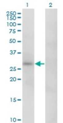 Western Blot: Carbonic Anhydrase I/CA1 Antibody (1F1) [H00000759-M10]