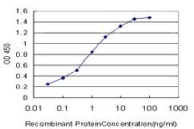 ELISA: Carbonic Anhydrase I/CA1 Antibody (7G12) [H00000759-M07]
