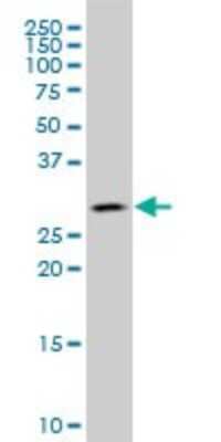 Western Blot: Carbonic Anhydrase I/CA1 Antibody (7G12) [H00000759-M07]