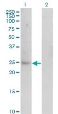 Western Blot: Carbonic Anhydrase I/CA1 Antibody (7G12) [H00000759-M07]