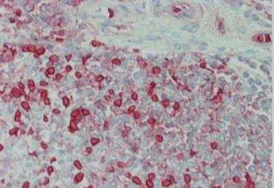 Immunohistochemistry: Carbonic Anhydrase I/CA1 Antibody [NB120-6619]
