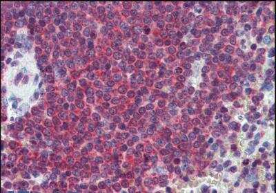 Immunohistochemistry-Paraffin: Carbonic Anhydrase I/CA1 Antibody [NBP1-36740]