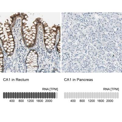 Immunohistochemistry-Paraffin: Carbonic Anhydrase I/CA1 Antibody [NBP1-88191]