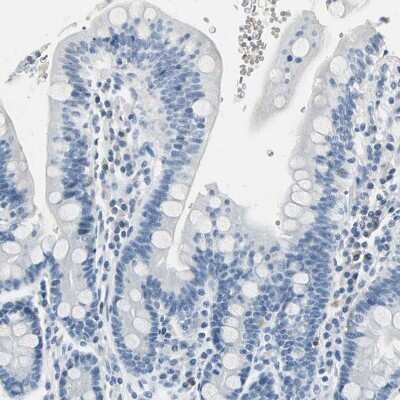 Immunohistochemistry-Paraffin: Carbonic Anhydrase I/CA1 Antibody [NBP1-88191]