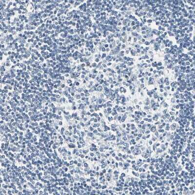 Immunohistochemistry-Paraffin: Carbonic Anhydrase I/CA1 Antibody [NBP1-88191]