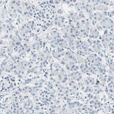 Immunohistochemistry-Paraffin: Carbonic Anhydrase I/CA1 Antibody [NBP1-88191]
