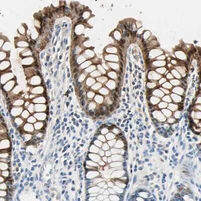 Immunohistochemistry-Paraffin: Carbonic Anhydrase I/CA1 Antibody [NBP1-88191]