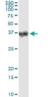Immunoprecipitation: Carbonic Anhydrase I/CA1 Antibody (M1) [H00000759-M05]