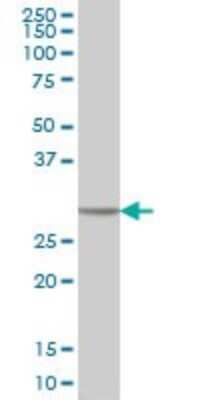 Western Blot: Carbonic Anhydrase I/CA1 Antibody (M1) [H00000759-M05]