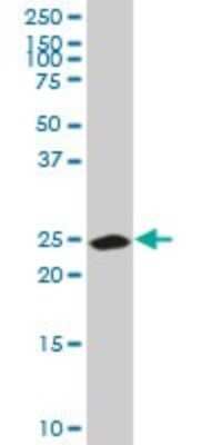 Western Blot: Carbonic Anhydrase I/CA1 Antibody (M1) [H00000759-M05]