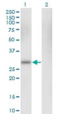 Western Blot: Carbonic Anhydrase I/CA1 Antibody (M1) [H00000759-M05]