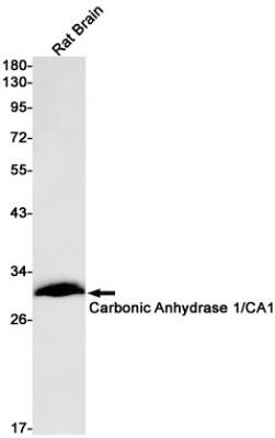 Western Blot: Carbonic Anhydrase I/CA1 Antibody (S03-8F1) [NBP3-19591]