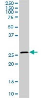 Western Blot: Carbonic Anhydrase I/CA1 Antibody [H00000759-D01P]