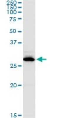 Western Blot: Carbonic Anhydrase I/CA1 Antibody [H00000759-D01P]