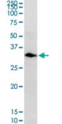 Western Blot: Carbonic Anhydrase I/CA1 Antibody [H00000759-D01P]